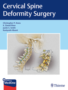 Hardcover Cervical Spine Deformity Surgery Book