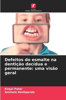 Paperback Defeitos do esmalte na dentição decídua e permanente: uma visão geral [Portuguese] Book
