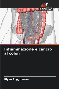 Paperback Infiammazione e cancro al colon [Italian] Book