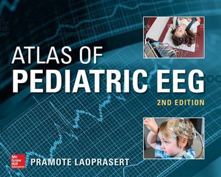 Hardcover Atlas of Pediatric Eeg, 2nd Edition Book
