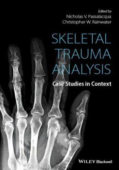 Hardcover Skeletal Trauma Analysis Book