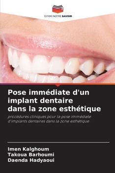 Pose immédiate d'un implant dentaire dans la zone esthétique (French Edition)