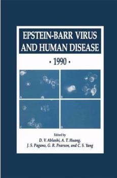 Paperback Epstein-Barr Virus and Human Disease - 1990 Book