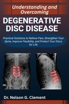 UNDERSTANDING AND OVERCOMING DEGENERATIVE DISC DISEASE: Practical Solutions to Relieve Pain, Strengthen Your Spine, Improve Flexibility, and Protect Your Discs for Life
