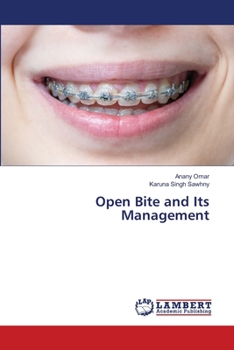 Paperback Open Bite and Its Management Book