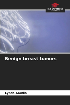 Paperback Benign breast tumors Book