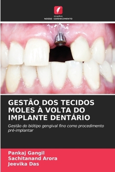 Gestão DOS Tecidos Moles À VOLTA Do Implante Dentário (Portuguese Edition)