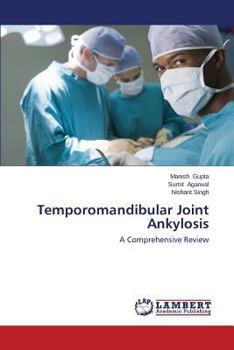 Paperback Temporomandibular Joint Ankylosis Book