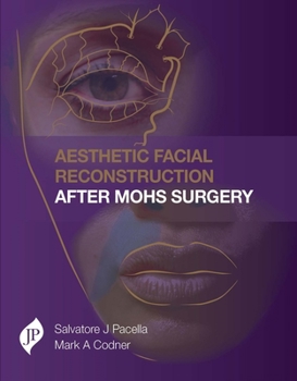 Hardcover Aesthetic Facial Reconstruction After Mohs Surgery Book