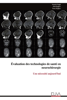 Évaluation des technologies de santé en neurochirurgie: Une nécessité aujourd'hui (French Edition)