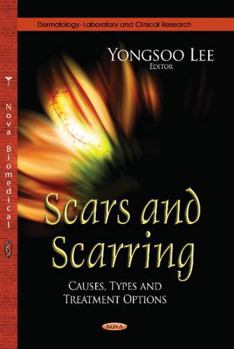 Hardcover Scars and Scarring: Causes, Types and Treatment Options (Dermatology - Laboratory and Clinical Research) Book