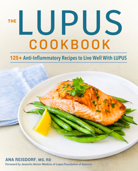 Paperback The Lupus Cookbook: 125+ Anti-Inflammatory Recipes to Live Well with Lupus Book