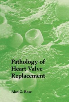 Paperback Pathology of Heart Valve Replacement Book