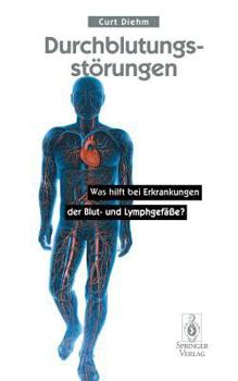 Paperback Durchblutungsstörungen: Was Hilft Bei Erkrankungen Der Blutund Lymphgefäße? [German] Book