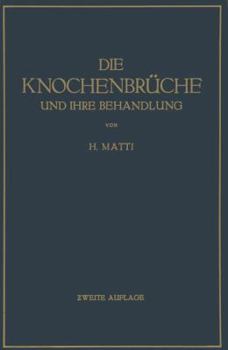 Paperback Die Knochenbrüche Und Ihre Behandlung: Ein Lehrbuch Für Studierende Und Ärzte [German] Book