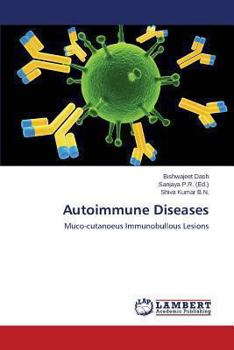 Paperback Autoimmune Diseases Book