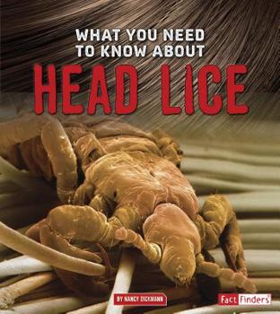 Paperback What You Need to Know about Head Lice Book