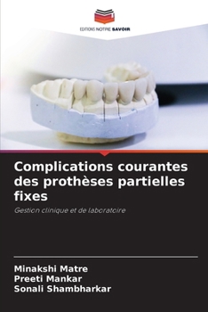 Paperback Complications courantes des prothèses partielles fixes [French] Book