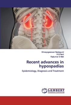 Recent advances in hypospadias: Epidemiology, Diagnosis and Treatment