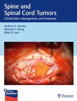 Hardcover Spine and Spinal Cord Tumors: Classification, Management, and Treatment Book