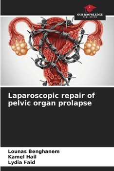 Paperback Laparoscopic repair of pelvic organ prolapse Book