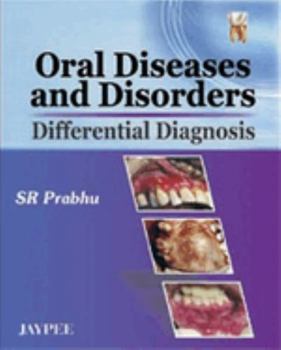 Paperback Oral Diseases and Disorders: Differential Diagnosis Book