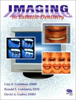 Hardcover Imaging in Esthetic Dentistry Book