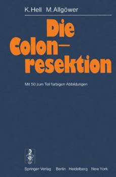 Paperback Die Colonresektion [German] Book