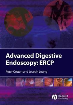 Hardcover Advanced Digestive Endoscopy: ERCP Book