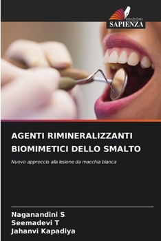 Paperback Agenti Rimineralizzanti Biomimetici Dello Smalto [Italian] Book