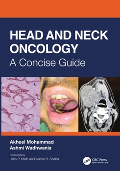 Paperback Head and Neck Oncology: A Concise Guide Book