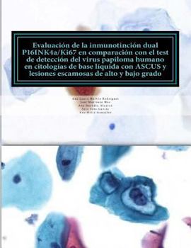 Paperback EVALUACION DE LA INMUNOTINCION DUAL P16INK4a/Ki67 EN COMPARACION CON EL TEST DEL VIRUS DEL PAPILOMA HUMANO EN CITOLOGIAS DE BASE LIQUIDA CON ASCUS Y L [Spanish] Book