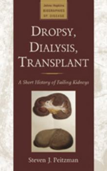 Dropsy, Dialysis, Transplant: A Short History of Failing Kidneys - Book  of the Johns Hopkins Biographies of Disease