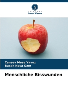 Paperback Menschliche Bisswunden [German] Book