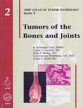 Hardcover Tumors of the Bones and Joints Book