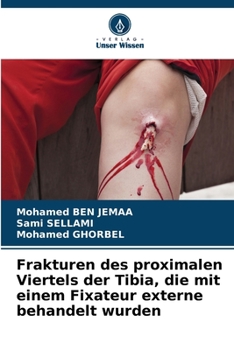 Paperback Frakturen des proximalen Viertels der Tibia, die mit einem Fixateur externe behandelt wurden [German] Book