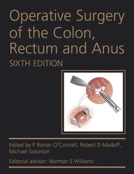 Operative Surgery of the Colon, Rectum and Anus. by L. Peter Fielding, Ronan O'Connell, Robert Madoff