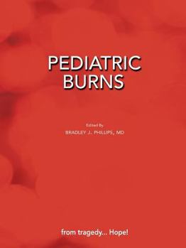 Paperback Pediatric Burns (Paperback Edition) Book