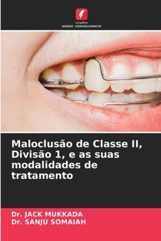 Maloclusão de Classe II, Divisão 1, e as suas modalidades de tratamento (Portuguese Edition)