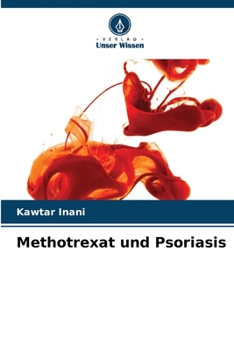 Paperback Methotrexat und Psoriasis [German] Book