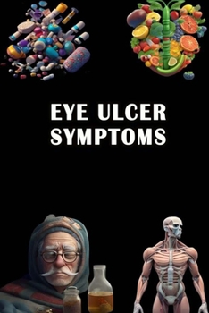 Paperback Eye Ulcer Symptoms: Recognize Eye Ulcer Symptoms - Protect Your Vision and Seek Ophthalmic Care! Book