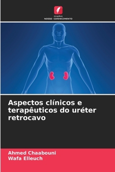 Paperback Aspectos clínicos e terapêuticos do uréter retrocavo [Portuguese] Book