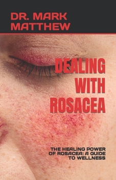 Paperback Dealing with Rosacea: The Healing Power of Rosacea: A Guide to Wellness Book