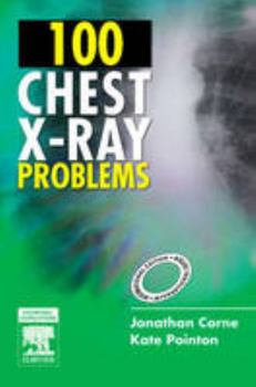 Paperback 100 Chest X-Ray Problems, International Edition Book