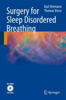 Paperback Surgery for Sleep Disordered Breathing Book