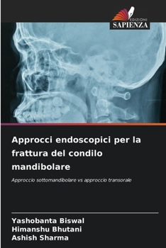 Paperback Approcci endoscopici per la frattura del condilo mandibolare [Italian] Book
