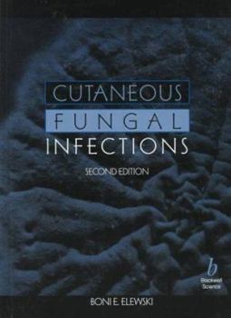 Hardcover Cutaneous Fungal Infections Book