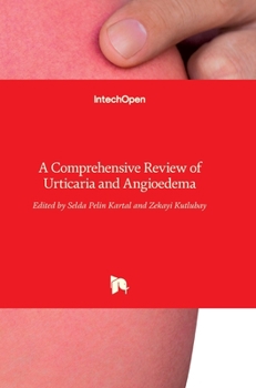 Hardcover Urticaria and Angioedema: A Comprehensive Review of Book