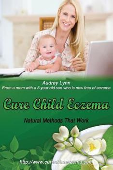 Paperback Cure Child Eczema: Natural Methods That Work Book
