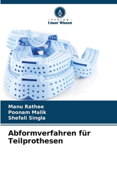 Paperback Abformverfahren für Teilprothesen [German] Book